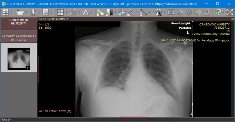 DICOM Viewer with Image and Metadata