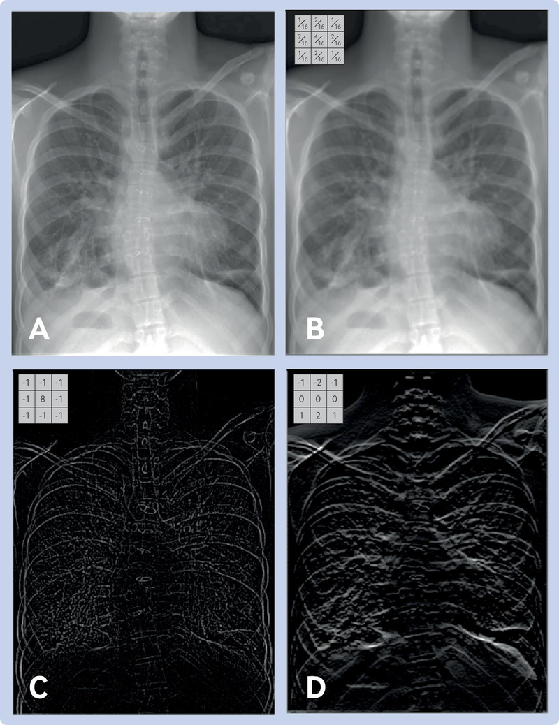 Grayscale X-ray and Pixel Intensity Values