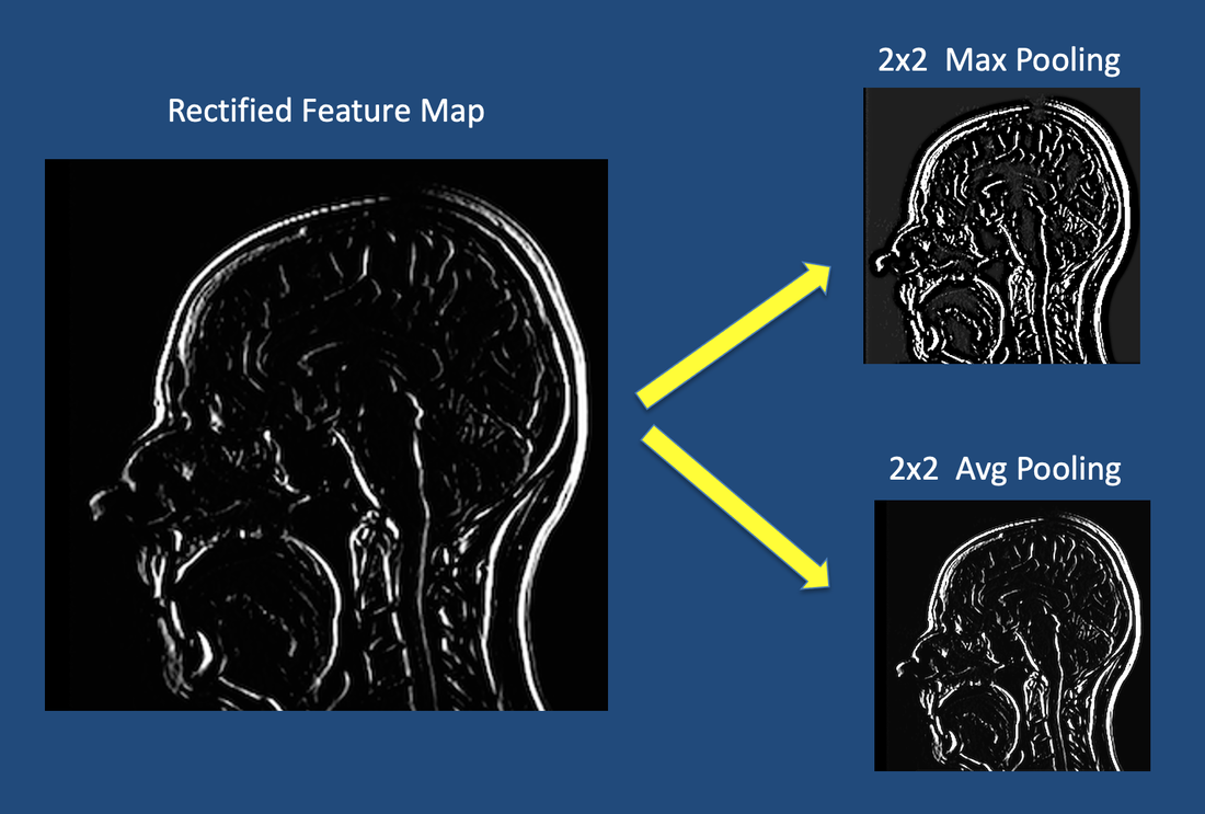 Max Pooling Operation