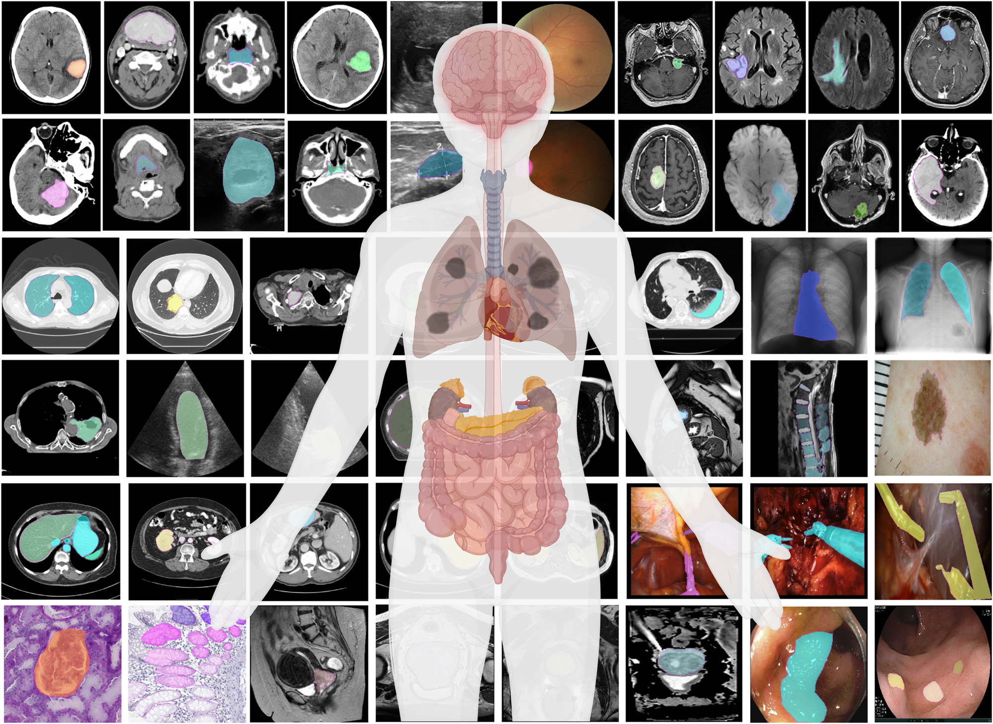 Organ Segmentation in MRI/CT