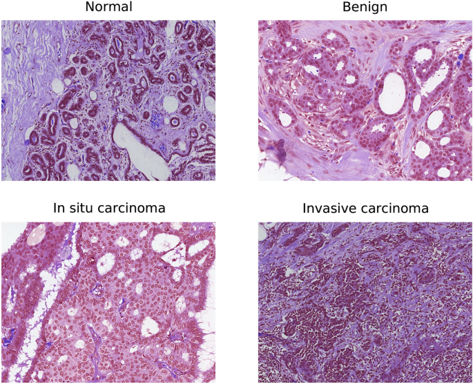 Digital Pathology Slide with Cell Classification