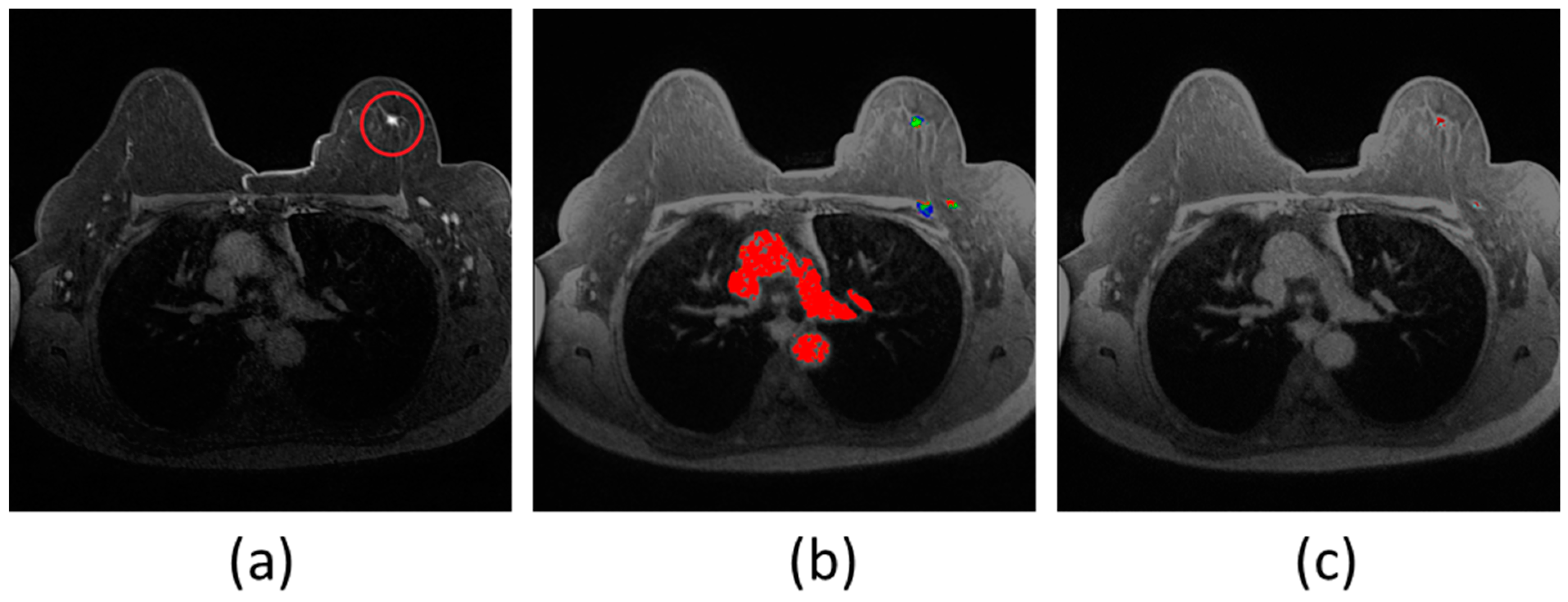 Image Segmentation Example: Input and Mask