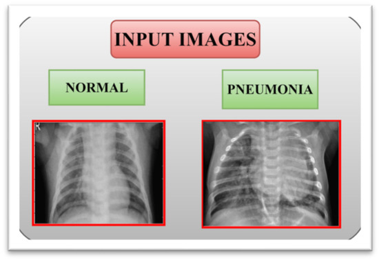 X-ray Classification Example